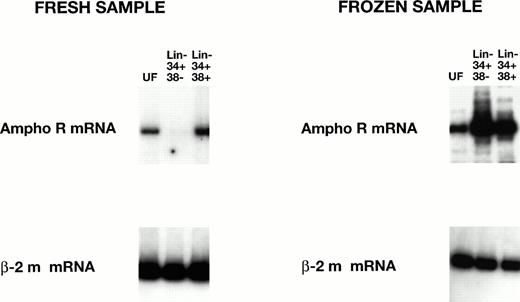 Fig. 3. RT-PCR analysis of amphotropic receptor (ampho R) mRNA levels in fresh and frozen human cord blood cells. The levels of mRNA encoding ampho R mRNA and β2-microglobulin mRNA in unfractionated (UF) Lin− CD34+ CD38− and Lin− CD34+ CD38+ cells were analyzed as in Fig 2. The level of ampho R mRNA in the HSC-enriched Lin− CD34+ CD38− fraction from frozen cord blood is significantly increased (P < .005) over the level of ampho R mRNA in the HSC-enriched Lin− CD34+ CD38−fraction from fresh cord blood (see Table 2).