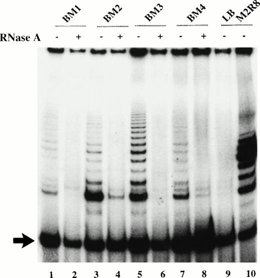 Fig. 1. Telomerase activity in candidate HSC before culture. TRAP products were generated from 2 μL of CHAPS extract (1,000 cell equivalents) in the presence (+) or absence (−) of RNase A. TRAP products generated from sorted cells on day 0 from 4 different cadaveric marrow (lanes 1 to 8); lane 9, no extract; lane 10, 1 amol M2R8 standard. Arrow indicates the position of the 35-bp amplified internal control.