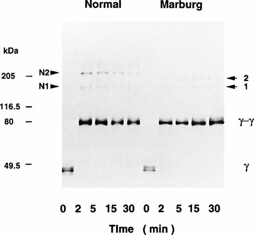 Fig. 3. Factor XIIIa–catalyzed cross-linking of the fibrin γ-chain analyzed by immunoblotting. Fibrinogen was clotted with thrombin and factor XIII in the presence of CaCl2. At timed intervals, the clots were subjected to SDS-PAGE followed by immunoblotting using an anti–γ-chain antibody. Besides the γ-dimer, high-molecular-weight polypeptides 1 and 2 were formed in the Marburg fibrin, and the corresponding peptides, N1 and N2, were formed in the normal fibrin. The molecular mass and the positions of the marker proteins are indicated in the left margin.