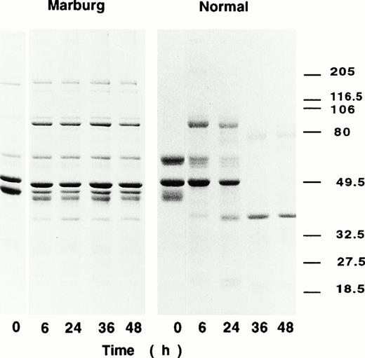 Fig. 4. Fibrin degradation by t-PA–catalyzed plasmin digestion. Fibrinogen was clotted with thrombin and factor XIII in the presence of plasminogen (1.0 nmol/L), t-PA (4 U/mL), and CaCl2. At 6 hours, 24 hours, 36 hours, and 48 hours, the reaction mixture was subjected to SDS-PAGE under reducing conditions.