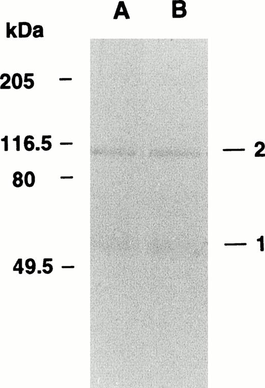Fig. 6. Behavior of fibrinogen-associated albumin in the cross-linked Marburg fibrin as analyzed by immunoblotting. Fibrinogen Marburg was clotted with thrombin and factor XIII in the presence (A) or absence (B) of α2-PI and then subjected to immunoblotting using an anti-human albumin antibody. Band 1 represents noncross-linked albumin, and band 2 represents the cross-linked albumin with a fibrin-derived subunit.