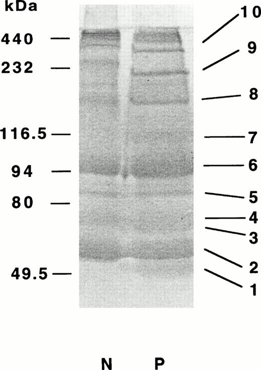 Fig. 7. Polypeptide compositions of proteins derived from α2-PI–incorporated cross-linked fibrin. Fibrinogen (90 μg) was clotted with thrombin and factor XIII for 30 minutes in the presence of CaCl2 and α2-PI. The clots were solubilized and subjected to PAGE in two lanes under reducing conditions followed by blotting onto PVDF-membranes as described in Materials and Methods. The protein bands were stained with CBB. Major bands 1-9 in the patient's sample were separetely subjected to amino-terminal sequence analysis.