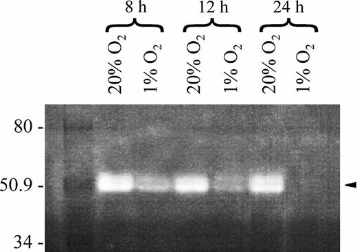 Fig. 6. Zymographic analysis of PAs present in the medium of HTR-8/SVneo cell cultures incubated for 8, 12, and 24 hours under normoxic or hypoxic conditions. Casein and plasminogen were incorporated into the acrylamide before polymerization as detailed elsewhere.17 Samples of serum-free medium containing 200 ng of protein were loaded onto each lane and separated by electrophoresis. After an overnight incubation in 5 mmol/L CaCl2 in TRIS buffer, gels were stained with Coomassie R-250 in 10% acetic acid/40% methanol and destained in 10% acetic acid/40% methanol. Clear areas represent caseinolytic activity. Note caseinolytic bands at 50 to 55 kD corresponding in size to uPA, and that at 24 hours of hypoxic culture, the caseinolytic bands were not discernible.
