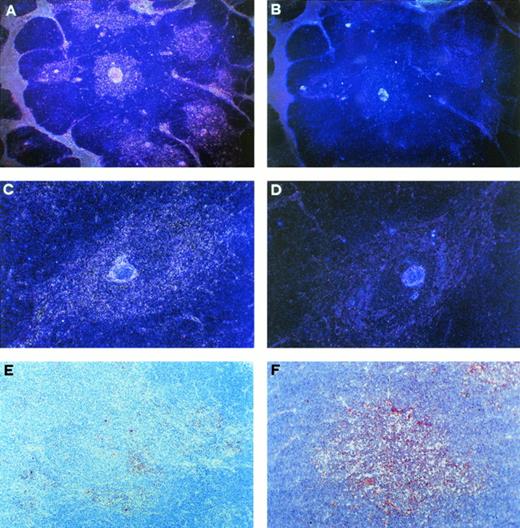 Fig. 2. Localization of CD30+ and IL-4R+ cells in the medullary areas of postnatal thymus. (A) Autoradiograph of a thymus cryostat section hybridized with 35S-labeled antisense CD30 probe, showing positive signal in the medullary areas and along the septa (dark field, original magnification ×40). (B) Autoradiograph of a consecutive section hybridized with sense CD30 probe, showing virtually no signal (dark field, original magnification ×40). (C) Autoradiograph of a thymic medullary area hybridized with antisense CD30 probe showing high CD30 mRNA expression (dark field, original magnification × 100). (D) Autoradiograph of a consecutive section hybridized with sense CD30 probe showing no signal (dark field, original magnification ×100). (E) CD30 immunoreactive cells in the thymic medulla. Section was immunostained with anti-CD30 MoAb, using the avidin-biotin-peroxidase method, and the AEC substrate (red color, original magnification ×100). (F) IL-4R immunoreactive cells in the thymic medulla (red color, original magnification ×100).