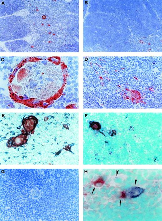 Fig. 3. CD30L expression by Hassal's corpuscles and medullary TEC in postnatal thymus. (A) CD30L immunoreactivity in the thymic medulla. Section was immunostained with anti-CD30L MoAb, using the avidin-biotin-peroxidase method, and the AEC substrate (red color, original magnification ×100). (B) CD30L immunoreactivity (red color), which is clearly visible in a medullary area (bottom right), limited to a few scattered cells in the cortex (original magnification ×100). (C) Strong CD30L immunoreactivity in the outer part of a Hassal's corpuscle (original magnification ×1,000). (D) CD30L immunoreactivity in some medullary cells (original magnification ×250). (E) Double immunostaining for CD30L and cytokeratin in the medullary area. CD30L was identified by using the AEC substrate (red color) and cytokeratin by using the Vector SG substrate (bluish-grey color). Hassal's corpuscles and some cells staining for both cytokeratin and CD30L (purple-brown color), as well as many cells staining for cytokeratin alone, are visible (original magnification ×400). (F) Double immunostaining for CD30L (red color) and TE4 (bluish-grey color). Cells staining for both CD30L and TE4 (purple-brown color), as well as cells staining for TE4 alone, are visible (original magnification ×400). (G) Absence of immunostaining in a thymic medullary section where the anti-CD30L Ab was replaced by an isotype-matched control MoAb (original magnification ×400). (H) Double immunostaining showing distinct cellular distribution for CD30 (red color, arrows) and CD30L (bluish-grey color, arrowheads, original magnification ×1,000).