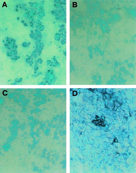 Fig. 4. CD30L expression and detection of apoptotic cells in fetal and postfetal human thymuses. (A) Large numbers of cytokeratin-positive cells (bluish-grey color) in a fetal thymus specimen taken at week 11 of gestation (original magnification ×100). (B) Absence of TE4 and (C) absence of CD30L immunostaining (bluish-grey color) in the same fetal thymus (original magnification ×100). (D) Large numbers of cytokeratin-positive cells (bluish-grey color) in a fetal thymus taken at week 13 of gestation (original magnification ×400). (E) Several cells in a adjacent section staining positive for TE4 (bluish-grey color original magnification ×400). (F) A few cells in an adjacent section showing CD30L immunoreactivity (bluish-grey color, original magnification ×400). (G) Apoptotic cells detected by the TUNEL technique (red color) in a postnatal fetal thymus (original magnification ×100). (H) Absence of apoptotic cells in a fetal thymus taken at week 11 of gestation (original magnification ×100).