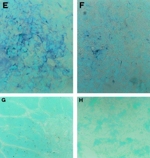 Fig. 4. CD30L expression and detection of apoptotic cells in fetal and postfetal human thymuses. (A) Large numbers of cytokeratin-positive cells (bluish-grey color) in a fetal thymus specimen taken at week 11 of gestation (original magnification ×100). (B) Absence of TE4 and (C) absence of CD30L immunostaining (bluish-grey color) in the same fetal thymus (original magnification ×100). (D) Large numbers of cytokeratin-positive cells (bluish-grey color) in a fetal thymus taken at week 13 of gestation (original magnification ×400). (E) Several cells in a adjacent section staining positive for TE4 (bluish-grey color original magnification ×400). (F) A few cells in an adjacent section showing CD30L immunoreactivity (bluish-grey color, original magnification ×400). (G) Apoptotic cells detected by the TUNEL technique (red color) in a postnatal fetal thymus (original magnification ×100). (H) Absence of apoptotic cells in a fetal thymus taken at week 11 of gestation (original magnification ×100).