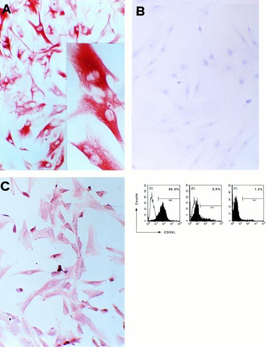 Fig. 5. CD30L expression in a cultured TEC clone derived from postnatal human thymus. (A) Immunostaining for cytokeratin of cultured cells from a thymic clone; cells were fixed in acetone and stained by using the avidin-biotin-peroxidase method and the AEC substrate (red color, original magnification ×100); inset: high-power magnification of three cells showing intense cytokeratin immunoreactivity (original magnification ×250). (B) Absence of reactivity by the same cells stained with an isotype-matched control MoAb (original magnification ×100). (C) Immunostaining for CD30L of cultured epithelial cells from the same postnatal thymus clone; cells were fixed in 4% paraformaldehyde and staining was performed by using the avidin-biotin-peroxidase method and the AEC substrate (red color, original magnification ×100). (D) Detection of CD30L expression on cultured cells from the same postnatal thymus clone by flow cytometry. Cells (1 × 106/mL) were resuspended in PBS containing 0.5% BSA and 0.02% sodium azide and incubated with anti-CD30L (black area) or isotype-matched control (white area) MoAb, followed by FITC-conjugated anti-mouse IgG2b goat Ab. Absence of CD30L expression in cultured kidney glomerular epithelial cells (E) and in cultured T lymphocytes obtained from the same postnatal thymus (F).