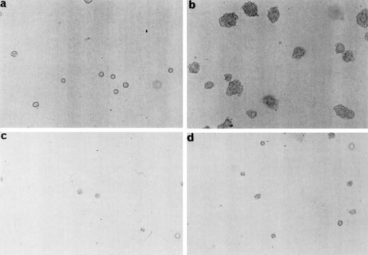 Fig. 4. Expression of a dominant negative mutant of Myc impairs soft-agar colony formation by TEL/PDGFRβ. The Rat-1 expressing dominant negative mutants of Myc (MycRX, Max2RX) and transfected with the TEL/PDGFRβ vector or the control vector were plated in soft agar and the formation of colonies was assessed after 2 weeks of culture. (a) Rat-1 MycRX/Max2RX, (b) Rat-1 MycRX/Max2RX expressing TEL/PDGFRβ, (c) Rat-1 Max2RX, (d) Rat-1 Max2RX expressing TEL/PDGFRβ, (e) Number of colonies per dish. Only the colonies < 0.3 mm were counted. This is representative of three independent experiments.