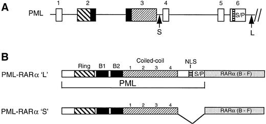 Fig. 1. (A) Schematic diagram of the 5′ region of the PML gene showing the two major breakpoint regions (designated by vertical arrows) involved in formation of the chimeric PML-RARα fusion gene. PML exons (rectangles) are numbered. (B) Schematic drawing of the PML-RARα ‘L’ and ‘S’ isoforms, created by fusion of the RARα B through F domains with PML exon 6 or PML exon 3, respectively. Motifs in the PML gene common to each isoform include a Ring finger (Ring) followed by two B-boxes (B1 and B2) and a coiled-coil domain consisting of four distinct coils. A putative nuclear localization signal (NLS) and a serine/proline-rich region (S/P) are located in PML exon 6 and are not present in the PML-RARα S isoform.