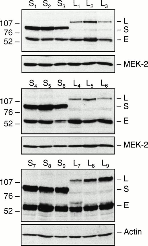Fig. 2. Expression of PML-RARα in TF1-S and TF1-L clones. Equal amounts of total cellular protein from nine independent TF1-S and TF1-L clones were immunoblotted with an antibody to human RARα, as detailed in Materials and Methods. Molecular weights are indicated to the left of the gel in kilodaltons (×10−3). The polyclonal RARα antibody detects both endogenous RARα (E, at approximately 55 kD), as well as the fusion PML-RARα proteins (S isoform, approximately 95 kD; L isoform, approximately 110 kD). The blots were stripped and reprobed with either MEK-2 or actin antibodies as a control for differences in loading and transfer.