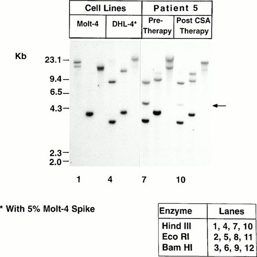 Fig. 2. TCR-β gene rearrangements shown by Southern blot analysis in Patient 5's peripheral blood cells before and after CSA therapy. The abnormal band is indicated by an arrow. Molt-4 and DHL-4 cells are shown as positive and negative controls, respectively.