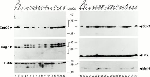 Fig. 1. Representative immunoblot data for apoptosis-regulatory proteins in B-CLLs. Detergent lysates from B-CLLs were normalized for total protein content (25 μg per lane) and subjected to SDS-PAGE/immunoblot assay (12% gels) using various antibodies and a method for sequential detection of multiple antigens from the same blot.31 Representative ECL results are shown for 2 groups of patients (left/right). The t(14;18)-containing B-cell lymphoma line RS11846 and a B-lymphoblastoid line BJAB are shown for comparison. Note that BAG-1 was present as two proteins. Preliminary data suggest that the larger of these may represent a phosphorylated version of the protein (unpublished observations). Both bands were combined for densitometric scanning analysis.