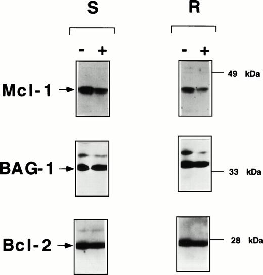 Fig. 5. Fludarabine induces declines in Mcl-1 protein levels in B-CLLs in vitro. Representative immunoblot data are presented for CLL specimens that exhibited in vitro resistance (IC50 > 10−5 mol/L) (R) or sensitivity (IC50 < 10−5 mol/L) (S) to fludarabine. CLLs were cultured at 2 × 106 cells/mL with or without 1 μmol/L fludarabine, then lysed in 1% Triton X-100–containing solution, and subjected to SDS-PAGE/immunoblot assay after normalization of samples for total protein content (25 μg/lane). The same blot was incubated with antibodies specific for Mcl-1 (top), BAG-1 (middle), and Bcl-2 (bottom).