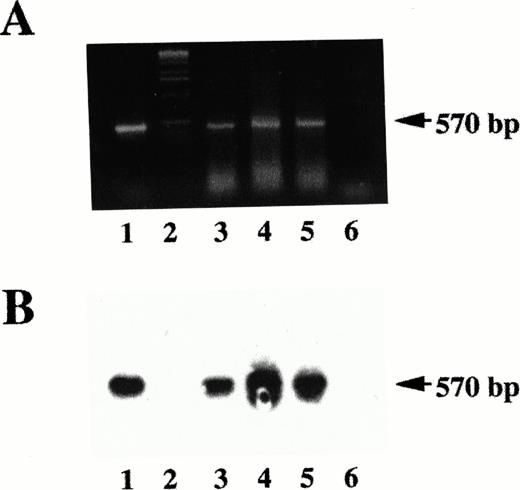 Fig. 2. RT-PCR analysis of Lck expression in B-CLL. (A) Ethidium bromide staining of the amplification products of an Lck-specific first-strand cDNA retrotranscribed from the mRNA from either CLL B cells (lanes 3 and 4) or control T cells (lane 2) or THP-1 cells (lane 6). PCR amplification of the same region of the Lck coding sequence from a pGEX-Lck construct is shown (lane 1). Lane 2, molecular-weight marker. (B) Phosphorimager print of a Southern blot hybridization of the same samples with 32P-labeled Lck cDNA.