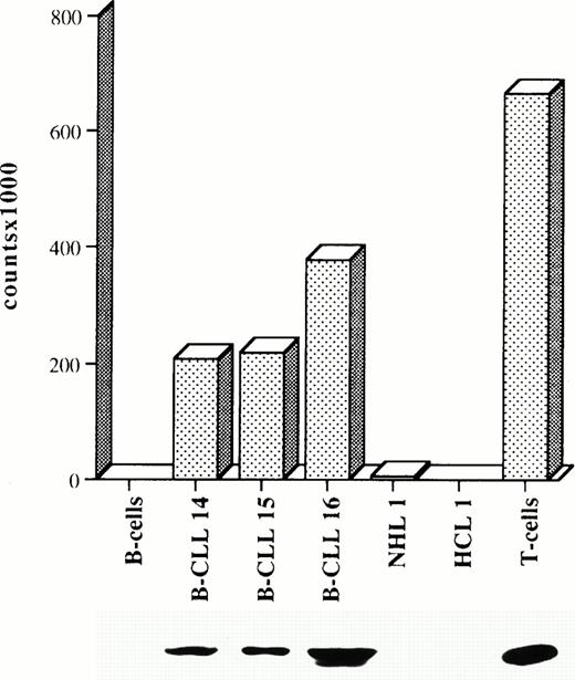Fig. 3. Lck is functional in CLL B cells. Quantitation of32P labeling of enolase by Lck in in vitro kinase assays of lysates of either normal peripheral blood B cells or B cells from three representative B-CLL patients (B-CLL), a hairy cell leukemia (HCL) patient, a patient with non-Hodgkin's lymphoma (NHL) in the leukemic phase, or normal T cells. Equal amounts of proteins for each lysate were used for Lck immunoprecipitation. An anti-Lck immunoblot of the same samples is shown below the graph. Each kinase assay was repeated at least twice.