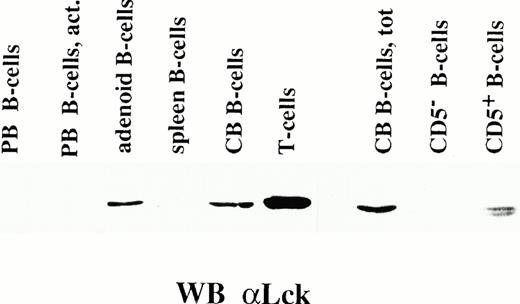 Fig. 4. Expression of Lck in normal CD5+ B cells. Immunoblot analysis using an anti-Lck MoAb of lysates from normal B cells from different lymphoid organs. On the right is shown a similar immunoblot of lysates of total cord blood B cells (CB), as well as of the purified CD5− and CD5+ B-cell populations from the same cord blood sample. A lysate from normal T cells is included as a positive control. PB, resting peripheral blood B cells; PB act, peripheral blood B cells activated by surface IgM cross-linking; spleen, B cells purified from spleen; adenoid, B-cells purified from adenoid, CB, cord blood B cells.