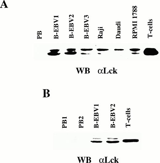 Fig. 5. Expression of Lck in EBV-transformed B cells. (A) Immunoblot analysis using an anti-Lck MoAb of lysates from EBV-transformed lymphoblastoid B-cell lines, or Daudi, Raji, and RPMI-1788 B-cell lines. A lysate from normal T cells is included as a positive control, as well as a lysate from normal peripheral blood B cells as a negative control (PB). (B) Immunoblot analysis using an anti-Lck MoAb of lysates from either freshly isolated peripheral B cells from healthy controls (PB1, PB2) or EBV-transformed lymphoblastoid B-cell lines from the same controls (B-EBV1, B-EBV2). A lysate from normal T cells is included as a positive control.