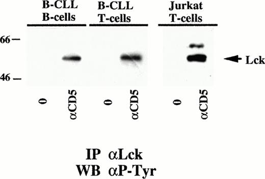 Fig. 6. Lck is functionally coupled to CD5 in CLL B cells. Immunoblot analysis using anti-phosphotyrosine MoAb of Lck-specific immunoprecipitates from lysates of either purified B and T cells from a representative B-CLL patient or from control Jurkat T cells. The migration of Lck, as revealed by immunoblot with an anti-Lck MoAb of a control Jurkat T-cell lysate on the same gel, is indicated.