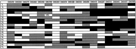 Fig. 2. Eighteen ALL patients with LOH on chromosome 6. Six ALL patients with LOH in very evaluable marker on chromosome 6 are not shown in the figure. Filled box (▪) indicates retention of two alleles. White box (□) indicates LOH. Diagonally striped box (▧) indicates that the marker was not informative and reversed stripes (▨) that the marker was not evaluable or not done. MSI indicates microsatellite instability.