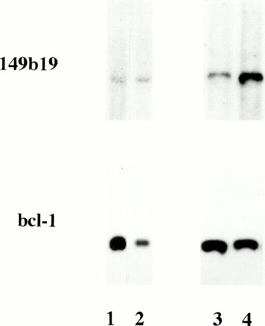 Fig. 3. Autoradiographs of Msp I—digested DNA, hybridized to the 149b19 probe on chromosome 6 and aBCL-1 probe. ALL patient 56 (lane 1) and patient 64 (lane 3) had LOH on chromosome 6 in the PCR analysis. Lane 2 contains normal DNA and lane 4 contains DNA from an ALL patient without LOH. There is a reduced signal in DNA from patients 56 and 64, indicating a hemizygous deletion of the 149b19 marker.