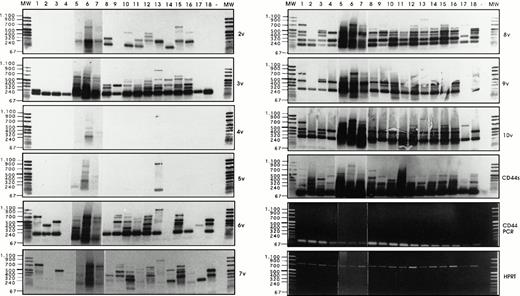 Fig. 6. Analysis of CD44v exon composition in normal myeloid and AML leukemic cells. RNA and cDNA were prepared as described in Materials and Methods. Using primers for HPRT, the amounts of cDNA were equilibrated to this internal standard. A CD44-specific PCR was performed and the PCR products were blotted and hybridized with33P-labeled exon-specific probes indicated at each blot. Represented are the autoradiographs and the photos taken from the CD44 and HPRT-PCR reaction products as indicated. Negative controls (−) were performed by omitting the cDNA. (1) Normal myeloid cells: CD34+ cells, blot A, lanes 1, 2, 3, CD34−granulocytic precursors GP (blot A, lane 4), PMN (blot A, lane 5), and monocytes (blot A, lanes 6 and 7). RT-PCR has been performed on five distinct samples of PMN, monocytes, GP, and CD34+ cells. Similar results have been obtained (data not shown). (2) Leukemic cells from AML patients with the following FAB types: M1 (blot A, lanes 8 through 14), M2 (blot A, lanes 15 through 18), M3 (blot B, lanes 1 through 4), M4 (blot B, lanes 5 through 11) and M5 (blot B, lanes 12 through 16). The sample shown on blot B lane 17 is from a patient with acute lymphoid leukemia. (3) Control experiment: Lymphocytes (lane 1) or monocytes (lane 3) were isolated from a patient with a myeloblastic AML (M1) and mixed in a ratio 5:95, with HL60 cells that express variant exons only very weakly (CD44vneg/low). The presence of 5% of lymphocytes from the AML patient did not result in the expression of any detectable 6v signal (lane 2), and only a faint expression of CD44-6v in the directly spliced version resulted from the presence of 5% of monocytes from the AML patient (lane 4). {/ANNT;4224n;;0n;0n}3
