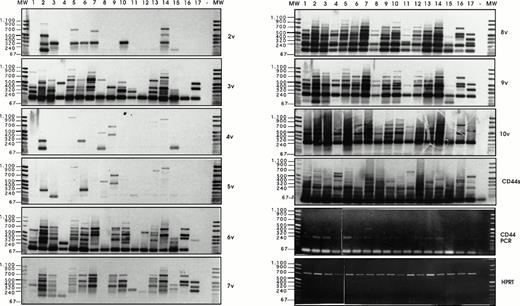 Fig. 6. Analysis of CD44v exon composition in normal myeloid and AML leukemic cells. RNA and cDNA were prepared as described in Materials and Methods. Using primers for HPRT, the amounts of cDNA were equilibrated to this internal standard. A CD44-specific PCR was performed and the PCR products were blotted and hybridized with33P-labeled exon-specific probes indicated at each blot. Represented are the autoradiographs and the photos taken from the CD44 and HPRT-PCR reaction products as indicated. Negative controls (−) were performed by omitting the cDNA. (1) Normal myeloid cells: CD34+ cells, blot A, lanes 1, 2, 3, CD34−granulocytic precursors GP (blot A, lane 4), PMN (blot A, lane 5), and monocytes (blot A, lanes 6 and 7). RT-PCR has been performed on five distinct samples of PMN, monocytes, GP, and CD34+ cells. Similar results have been obtained (data not shown). (2) Leukemic cells from AML patients with the following FAB types: M1 (blot A, lanes 8 through 14), M2 (blot A, lanes 15 through 18), M3 (blot B, lanes 1 through 4), M4 (blot B, lanes 5 through 11) and M5 (blot B, lanes 12 through 16). The sample shown on blot B lane 17 is from a patient with acute lymphoid leukemia. (3) Control experiment: Lymphocytes (lane 1) or monocytes (lane 3) were isolated from a patient with a myeloblastic AML (M1) and mixed in a ratio 5:95, with HL60 cells that express variant exons only very weakly (CD44vneg/low). The presence of 5% of lymphocytes from the AML patient did not result in the expression of any detectable 6v signal (lane 2), and only a faint expression of CD44-6v in the directly spliced version resulted from the presence of 5% of monocytes from the AML patient (lane 4). {/ANNT;4224n;;0n;0n}3