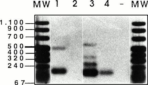 Fig. 6. Analysis of CD44v exon composition in normal myeloid and AML leukemic cells. RNA and cDNA were prepared as described in Materials and Methods. Using primers for HPRT, the amounts of cDNA were equilibrated to this internal standard. A CD44-specific PCR was performed and the PCR products were blotted and hybridized with33P-labeled exon-specific probes indicated at each blot. Represented are the autoradiographs and the photos taken from the CD44 and HPRT-PCR reaction products as indicated. Negative controls (−) were performed by omitting the cDNA. (1) Normal myeloid cells: CD34+ cells, blot A, lanes 1, 2, 3, CD34−granulocytic precursors GP (blot A, lane 4), PMN (blot A, lane 5), and monocytes (blot A, lanes 6 and 7). RT-PCR has been performed on five distinct samples of PMN, monocytes, GP, and CD34+ cells. Similar results have been obtained (data not shown). (2) Leukemic cells from AML patients with the following FAB types: M1 (blot A, lanes 8 through 14), M2 (blot A, lanes 15 through 18), M3 (blot B, lanes 1 through 4), M4 (blot B, lanes 5 through 11) and M5 (blot B, lanes 12 through 16). The sample shown on blot B lane 17 is from a patient with acute lymphoid leukemia. (3) Control experiment: Lymphocytes (lane 1) or monocytes (lane 3) were isolated from a patient with a myeloblastic AML (M1) and mixed in a ratio 5:95, with HL60 cells that express variant exons only very weakly (CD44vneg/low). The presence of 5% of lymphocytes from the AML patient did not result in the expression of any detectable 6v signal (lane 2), and only a faint expression of CD44-6v in the directly spliced version resulted from the presence of 5% of monocytes from the AML patient (lane 4). {/ANNT;4224n;;0n;0n}3