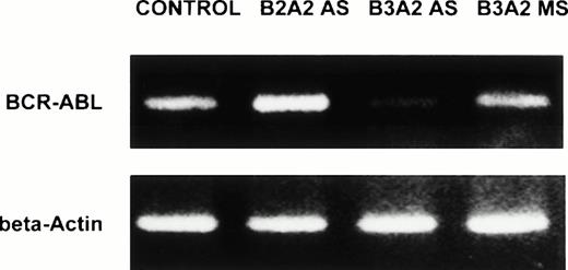 Fig. 6. Anti–BCR-ABL AS-ODNs inhibit BCR-ABL mRNA expression. CML DR+ cells were incubated in serum-free medium with or without addition of breakpoint-specific and control ODNs. PCR amplification of BCR-ABL mRNA extracted from 25,000 DR+cells was performed as described in the text, amplified samples were size separated by gel-electrophoresis, ethidium bromide stained, and photographed. β-Actin controls were run for each sample. In the representative experiment shown here, the b3a2breakpoint was present in the cells studied. Cells were incubated either without any ODNs (CONTROL), or with b3a2antisense ODNs (B3A2AS), b3a2 missense ODNs (B3A2MS), or b2a2 antisense ODNs (B2A2 AS).