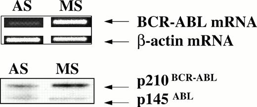 Fig. 7. Anti–BCR-ABL AS-ODNs inhibit p210BCR-ABLexpression. CML CD34+ cells from a patient with a known b3a2 BCR-ABL splice site were incubated in serum-free medium with addition of either breakpoint-specific antisense ODNs (AS) or with b3a2 specific missense ODNs (MS) for 48 hours as described in the legend. mRNA obtained from 20 × 103 cells was used for RT-PCR for either the BCR-ABL mRNA or β-actin (top panel). Protein extracts obtained from 1 × 106 cells were subjected to SDS-PAGE and Western blotting with an anti–c-ABL antibody (Ab3) as described in Materials and Methods (bottom panel).