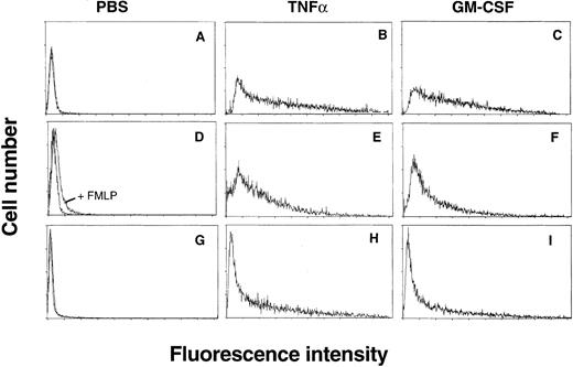 Fig. 3. Representative flow-cytometric histograms show the effects of priming on the FMLP-stimulated neutrophil respiratory burst. Shown are data from a healthy control (histograms A, B, and C), a SCD patient in steady-state (histograms D, E, and F), and a SCD patient in crisis (histograms G, H, and I). Whole-blood samples were incubated with either growth-factor diluent (histograms A, D, and G), 100 U/mL TNFα (histograms B, E, and H), or 10 ng/mL GM-CSF (histograms C, F, and I) for 30 minutes, followed by stimulation for 15 minutes with 1 μmol/L FMLP. Neutrophil H2O2 production was measured by the oxidation of DCF as described in Materials and Methods. Shown for comparison in histograms A, D, and G are the overlaid distributions of nonprimed samples stimulated with and without FMLP. In histograms A and G, the distributions ± FMLP were identical; in D, the stimulated distribution is marked with an arrow.
