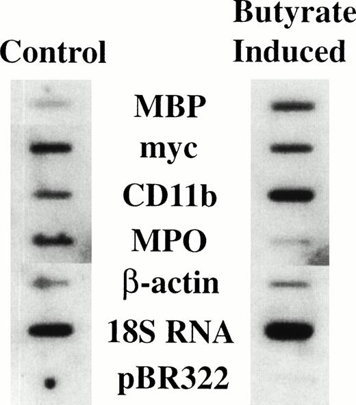 Fig. 1. Nuclear run-on assay of HL-60-C15 cells induced with n-butyrate. Nuclear run-on transcription analysis was performed with nuclei isolated from uninduced and 48-hour n-butyrate (0.5 mmol/L) induced HL-60-C15 cells. Equivalent numbers of counts were hybridized to duplicated filters containing equimolar amounts of the indicated probes.