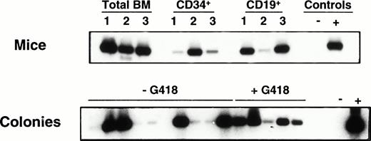 Fig. 4. PCR detection of NEO sequences in cells obtained from NOD/SCID recipients engrafted with infected human CB cells (Exp. 3 in Table 4). The upper panel shows results for total BM and isolated human CD34+ and CD19+ populations. The lower panel shows results for individual colonies derived from the sorted human CD34+ cells plated with and without G418. Densitometric analysis of the amount of DNA in each lane relative to PCR of the actin gene done on the same colonies were as follows: lanes 1 to 16: 0.8, 0.7, 0.7, 0.4, 0.3, 0.5, 1, 0.4, 0.4, 0.9, 0.7, 0.6, 0.4, 0.4, 0.7, 0.7. Because the NEO signal in lane 1 is weaker than expected relative to the amount of actin present, we have not called this colony positive.