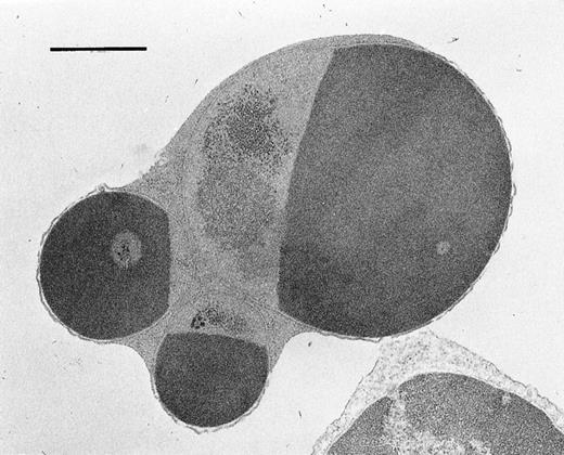 Fig. 3. Electron microscopic appearance of BM cells after treatment with anti-Fas antibody (Jo2) . Cells were cultured for 18 hours in the presence of Jo2. (Original magnification × 13,500.)