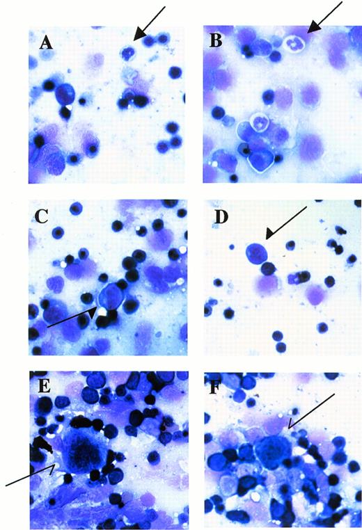 Fig. 4. Stamp specimens of fetal livers at E12.5 stained with May-Grünwald/Giemsa. (A and B) Arrows indicate granulocytes. (C and D) Arrows indicate monocytic cells. (E and F) Arrows indicate megakaryocytes. OM × 200. (A and E) Mll+/mu; (C) Mll+/+; (B, D, and F) Mllmu/mu.