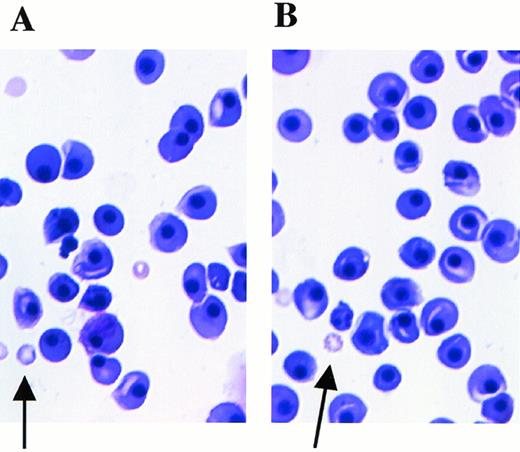 Fig. 7. Peripheral blood smears at E12.5 stained with May-Grünwald/Giemsa. Arrows indicate anucleated red blood cells derived from definitive hematopoiesis. (A) Mll+/mu; (B) Mllmu/mu.