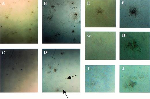Fig. 9. Examination of colonies derived from the colony-forming assays using fetal liver cells at E12.5. (A, C, E, G, and I) The appearance of the colonies at the 7th and (B, D, F, H, and J) at 14th days of culture. Arrows indicate small colonies that had appeared at 14th day of culture in Mllmu/mu. (E through J) Magnified views of single colony. (A, B, E, and F) Mll+/+; (C, D, G, H, I, andJ) Mllmu/mu.