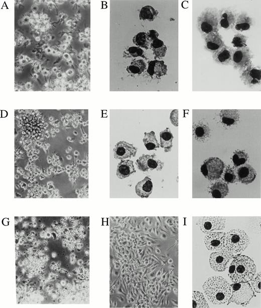 Fig. 3. The day 6 DC precursors differentiate into cells displaying a dendritic cell morphology at days 10 to 14. CD11b−/dullCD11c+ and CD11b+hiCD11c+ precursors were sorted from murine Lin−c-kit+ HPC cultures stimulated with GM-CSF + SCF + TNF-α for 6 days. A phase contrast microscopical observation (A, D, G, and H) and May-Grünwald-Giemsa staining (B, C, E, F, and I) were performed on sorted CD11b−/dullCD11c+ and CD11b+hiCD11c+ precursors or after culture for 5 to 8 additional days in the presence of GMCSF + TNF-α or M-CSF, respectively. (A and C) CD11b−/dullCD11c+ precursors cultured for 5 to 6 days in the presence of GM-CSF + TNF-α; (B) sorted CD11b−/dullCD11c+ precursors; (D and F) CD11b+hiCD11c+precursors cultured for additional 5 to 8 days in presence of GM-CSF + TNF-α; (E) sorted CD11b+hiCD11c+ precursors; (G) CD11b−/dullCD11c+ precursors cultured in the presence of M-CSF for 3 days; (H and I) cultured CD11b+hiCD11c+ precursors in the presence of M-CSF for 5 to 8 days. Original magnifications: (A) ×200; (D, G, and H) ×160; (B, C, E, F, and I) ×400.