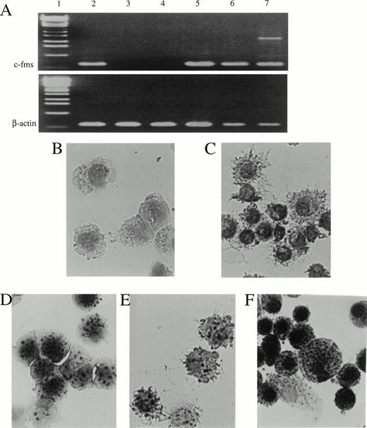 Fig. 4. Expression of c-fms mRNA and nonspecific esterase activity in CD11b−/dullCD11c+, CD11b+hiCD11c+ DC precursors, and their derived DCs. (A) Expression of c-fms mRNA was examined in the indicated cells using RT-PCR. Total RNAs were extracted from 1 × 105 indicated cells. The β-actin transcripts were used as control. Lane 1, 1-kb DNA ladder; 2, Lin−c-kit+ HPC; 3, CD11b−/dullCD11c+ precursor; 4, CD11b−/dullCD11c+ mature DC derived from CD11b−/dullCD11c+ precursors; 5, CD11b+hiCD11c+ precursor; 6, CD11b−/dullCD11c+ mature DC derived from CD11b+hiCD11c+ precursors; 7, macrophage derived from M-CSF–induced CD11b+hiCD11c+ DC precursors. (B through F) The cultured cells were sorted and processed for nonspecific esterase staining. (B) CD11b−/dullCD11c+precursors; (C) CD11b−/dullCD11c+precursor-derived CD11b−/dullCD11c+mature DCs; (D) CD11b+hiCD11c+ DC precursors; (E) CD11b+hiCD11c+ DC precursor-derived CD11b−/dullCD11c+ mature DCs; (F) macrophages derived from M-CSF–induced CD11b+hiCD11c+ DC precursors. Original magnification ×400.