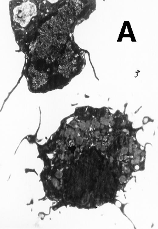 Fig. 5. Electron microscopy of typical CD11b−/dullCD11c+ precursor and its derived CD11b−/dullCD11c+ mature DCs. The CD11b−/dullCD11c+ precursors and its derived CD11b−/dullCD11c+ mature DCs were sorted at culture day 6 and day 12, respectively, and processed for electron microscopy staining as described in Materials and Methods. (A) A representative of CD11b−/dullCD11c+precursor sorted at day 6. Original magnification ×5,300. (B) A representative of CD11b−/dullCD11c+precursor-derived CD11b−/dullCD11c+ mature DC sorted at day 12. Original magnification ×5,300. (C) A representative of CD11b+hiCD11c+ precursor sorted at day 6. Original magnification ×9,600. (D) A representative of CD11b+hiCD11c+ precursor-derived mature DC with the phenotype of CD11b−/dullCD11c+sorted at day 12. Original magnification ×9,600.