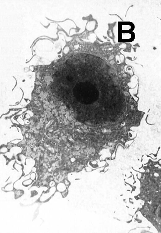 Fig. 5. Electron microscopy of typical CD11b−/dullCD11c+ precursor and its derived CD11b−/dullCD11c+ mature DCs. The CD11b−/dullCD11c+ precursors and its derived CD11b−/dullCD11c+ mature DCs were sorted at culture day 6 and day 12, respectively, and processed for electron microscopy staining as described in Materials and Methods. (A) A representative of CD11b−/dullCD11c+precursor sorted at day 6. Original magnification ×5,300. (B) A representative of CD11b−/dullCD11c+precursor-derived CD11b−/dullCD11c+ mature DC sorted at day 12. Original magnification ×5,300. (C) A representative of CD11b+hiCD11c+ precursor sorted at day 6. Original magnification ×9,600. (D) A representative of CD11b+hiCD11c+ precursor-derived mature DC with the phenotype of CD11b−/dullCD11c+sorted at day 12. Original magnification ×9,600.