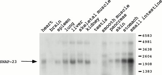 Fig. 6. Distribution of SNAP-23 mRNA in various mouse tissues. Poly(A)+ RNA (2 μg/lane) from various mouse tissues was hybridized with the SNAP-23 probe.