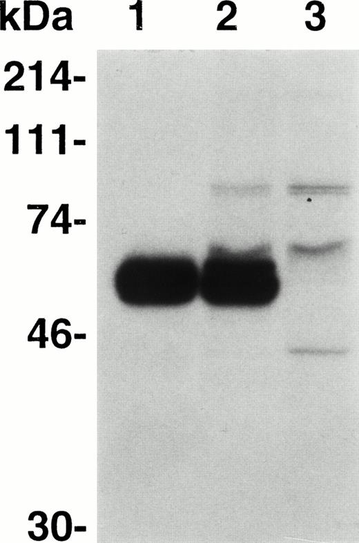 Fig. 1. Expression and secretion of A3-C1 polypeptide. Immunoprecipitation of 35 S-A3-C1 by MoAb CLB-CAg A IgG (30 μg/mL) was analyzed by 10% SDS-PAGE and autoradiography. The cellular and growth medium fractions were adjusted to equal volumes. Lane 1, culture medium; lane 2, cell lysate; lane 3, cell lysate without CLB-CAg A. Molecular weight standards are shown in kilodaltons (kDa) at the left.