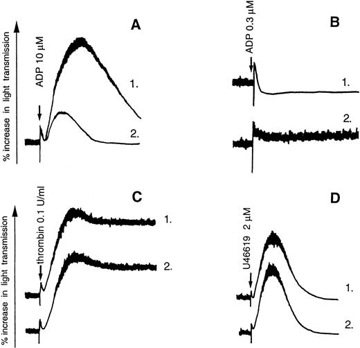 Fig. 1. Effects of A3P5P on ADP-induced aggregation of washed human platelets. (A) Platelet aggregation was induced by 10 μmol/L ADP alone (1) or in the presence of 100 μmol/L A3P5P (2). (B) Platelet shape change induced by 0.3 μmol/L ADP in the presence of 5 mmol/L EDTA (1) was inhibited by 100 μmol/L A3P5P (2). (C and D) A3P5P (100 μmol/L) (2) did not inhibit platelet aggregation induced by 0.1 U/mL thrombin (1, C) or 2 μmol/L U46619 (1, D) in the presence of 0.2 U/mL apyrase.