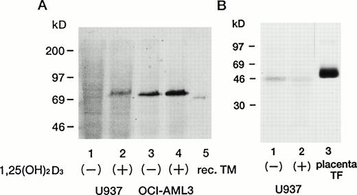 Fig. 4. Western blot analysis of TM and TF in leukemic cell lines treated with 1,25(OH)2D3. Cell lysates were subjected to immunoblotting analysis using a monoclonal anti-TM antibody (A), and a monoclonal anti-TF antibody (B). Sodium dodecyl sulfate-polyacrylamide gel electrophoresis (SDS-PAGE) was performed under nonreducing conditions. All cell lines were incubated either with (+) or without (−) 0.1 μmol/L 1,25(OH)2D3for 24 hours. Molecular-weight markers are shown along the left margin. Soluble recombinant TM (A, lane 5) and placenta TF (B, lane 3) were used as controls.