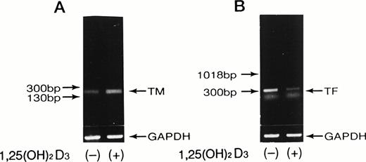 Fig. 5. RT-PCR and Northern blot analyses of TM and TF mRNA in U937 cells and monocytes treated with 1,25(OH)2D3. Total RNA was extracted from cultured U937 cells and monocytes after exposure to 0.1 μmol/L of 1,25(OH)2D3 (lane 2) for 5 hours. RT-PCR analysis of TM (A) or TF (B) mRNA and Northern blot analysis of TM mRNA (C) were performed as described in Materials and Methods. Base-pair markers are shown to the left. GAPDH and β-actin were used as quality controls of mRNA.