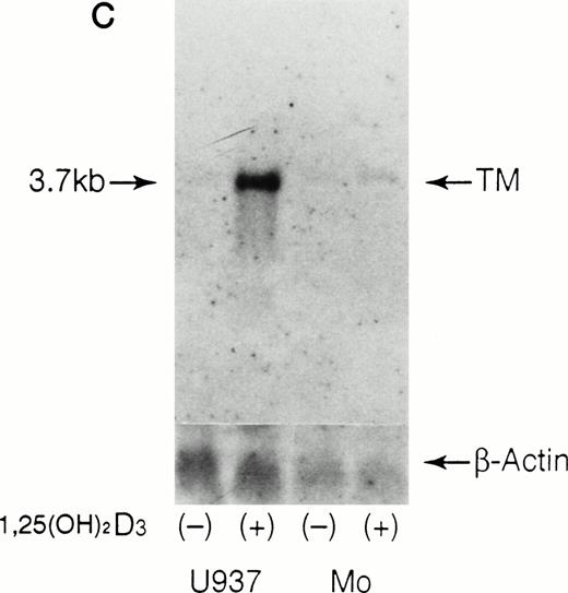 Fig. 5. RT-PCR and Northern blot analyses of TM and TF mRNA in U937 cells and monocytes treated with 1,25(OH)2D3. Total RNA was extracted from cultured U937 cells and monocytes after exposure to 0.1 μmol/L of 1,25(OH)2D3 (lane 2) for 5 hours. RT-PCR analysis of TM (A) or TF (B) mRNA and Northern blot analysis of TM mRNA (C) were performed as described in Materials and Methods. Base-pair markers are shown to the left. GAPDH and β-actin were used as quality controls of mRNA.