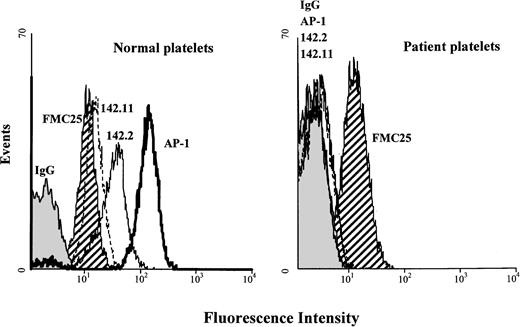 Fig. 2. Flow cytometric analysis of patients' and normal platelets. Analysis was performed on whole blood with monoclonal antibodies against GPIbα (AP1) and GPIIbIIIa (AP2). Platelets were then analyzed for their binding to the anti-GPIbα antibodies AP1 (solid bold line), 142.2 (solid line), and 142.11 (dashed line), the anti-GPIX antibody (hatched area), and an irrelevant mouse IgG (gray area). The anti-GPIbα antibodies bind to normal platelets, but not to those in this patient. There are similar amounts of GPIX on the surface of platelets from the patient and a normal volunteer.