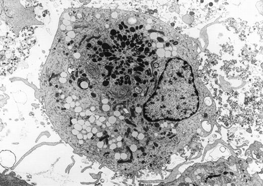 Human dendritic cell derived from peripheral blood progenitors with recombinant interleukin-4 and granulocyte-macrophage colony-stimulating factor (GM-CSF). The cells have long microvillous surface processes and numerous cytoplasmic lysosomes in addition to a well-formed golgi apparatus (uranyl acetate, lead citrate, original magnification ×2,500). (Courtesy of Jonathan W. Said, Kai Chien, Walter Verbeek, Jeffrey Weber, H. Phillip Koeffler, UCLA Center for the Health Sciences, University of Southern California, and Cedars Sinai Medical Center, Los Angeles, CA.) {/ANNT;80256n;;center;0n}