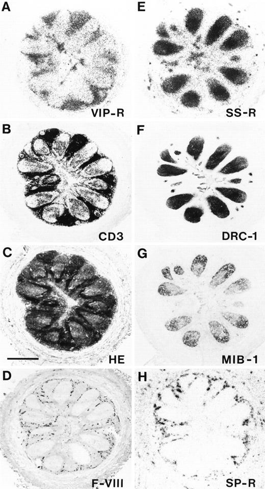 Fig. 1. Localization of VIP receptors, SS receptors, and SP receptors in the various compartments of a human appendix. Successive sections were used. (A) Autoradiogram showing total binding of125I-VIP. Predominant VIP receptor-location is in the zone surrounding lymphoid follicles. (B) CD3 immunohistochemical staining. (C) Hematoxylin-eosin stained section. Bar = 1 mm. (D) Blood vessels stained for F-VIII related antigen. (E) Autoradiogram showing total binding of 125I-Tyr3-octreotide. Predominant SS receptor location is in the germinal centers. (F) DRC-1 immunohistochemical staining for reticulum cells. (G) MIB-1 immunohistochemical staining for proliferating cells. (H) Autoradiogram showing total binding of 125I-BH-SP. Predominant SP receptor location is in the blood vessels, but not in lymphoid tissue.